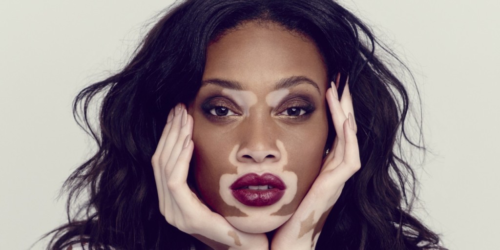 Chantelle Winnie: diversità come opportunità